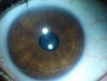 /album/iridologia/dsc00578-direita-luz-central-jpg/